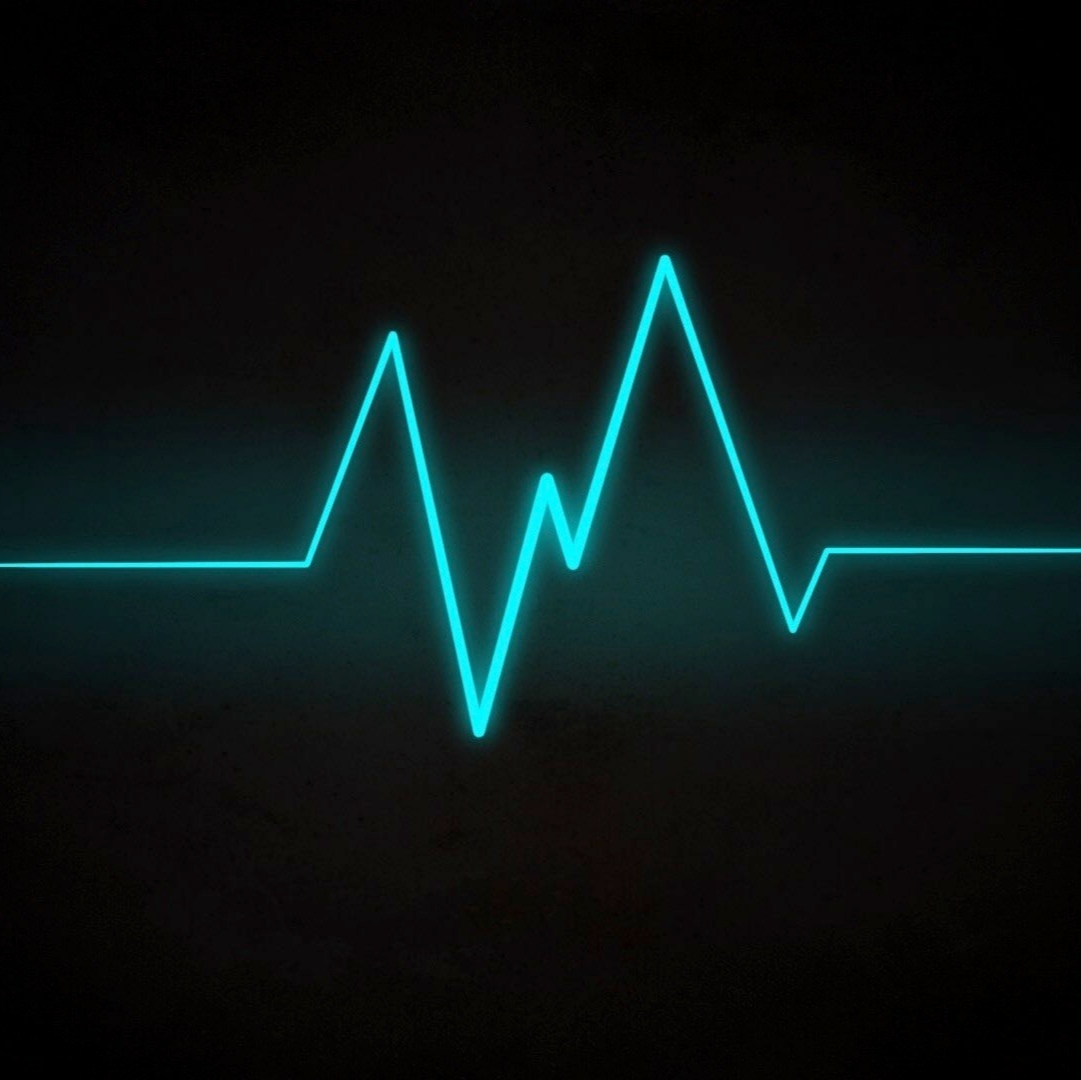 FX Pulse indicator